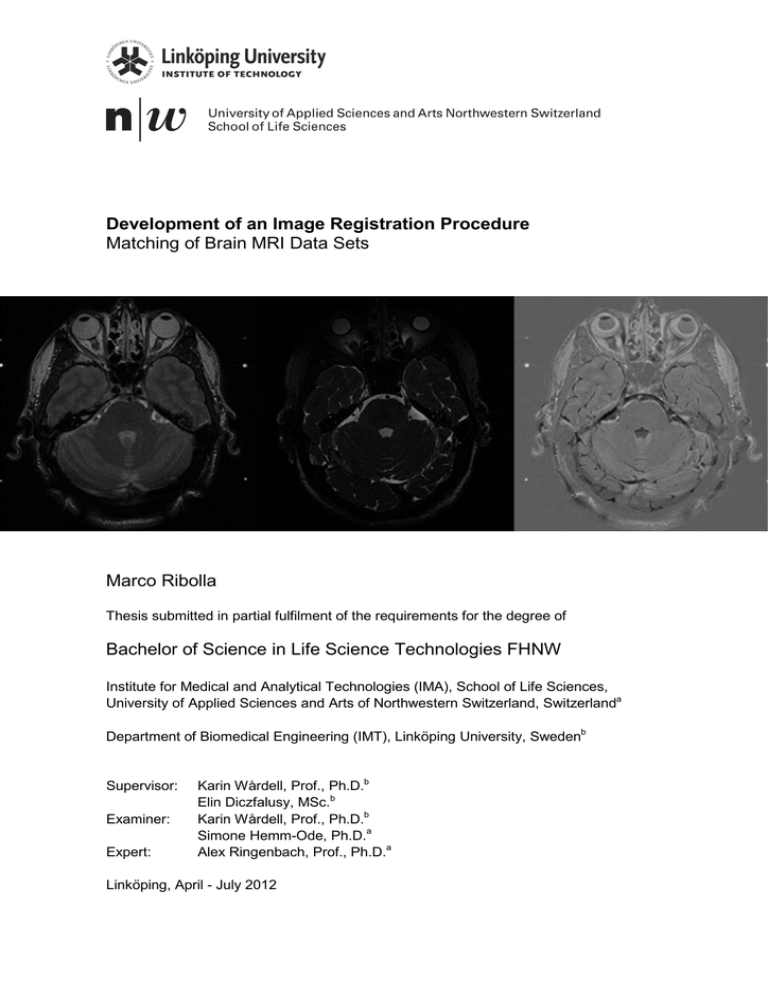 Development of an Image Registration Procedure Marco Ribolla Development of an Image Registration Procedure Marco Ribolla