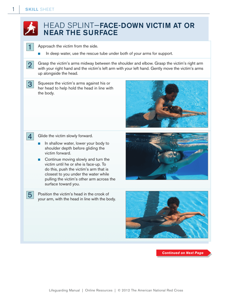 HEAD SPLINT—FACE-DOWN VICTIM AT OR NEAR THE SURFACE HEAD SPLINT—FACE-DOWN VICTIM AT OR NEAR THE SURFACE