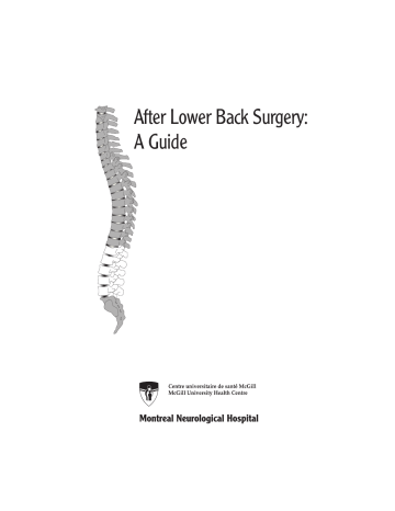 After Lower Back Surgery: A Guide After Lower Back Surgery: A Guide