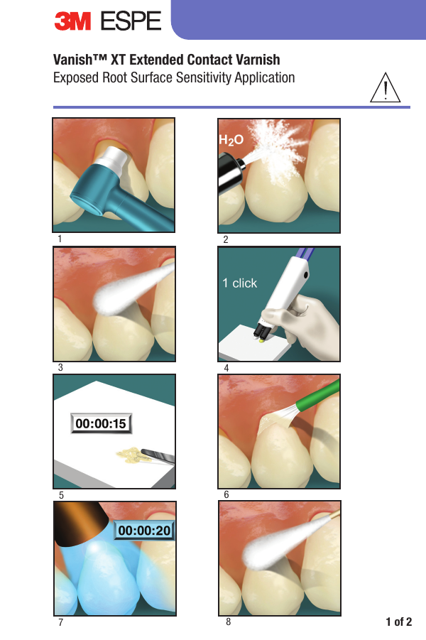 Clinpro Xt Varnish Outlet Here gbupresnenskij.ru