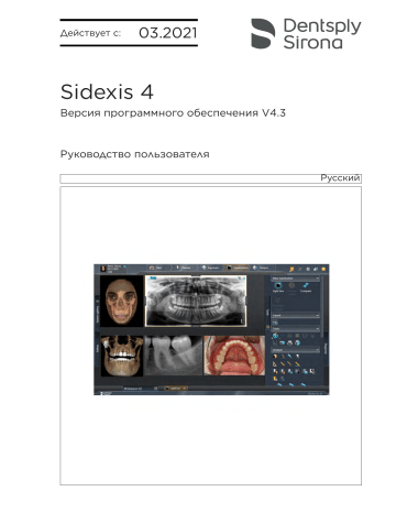 Dentsply Sirona Sidexis 4 Version 4.3.1 Инструкция по эксплуатации | Manualzz