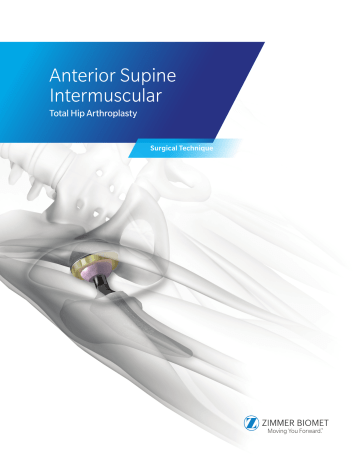 Zimmer Echo Hip System Owner's Manual | Manualzz