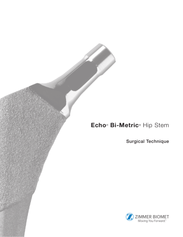 Zimmer Echo Hip System Owner's Manual | Manualzz