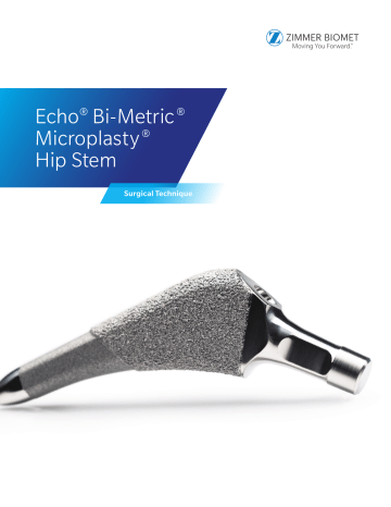 Zimmer Echo Hip System Owner's Manual | Manualzz